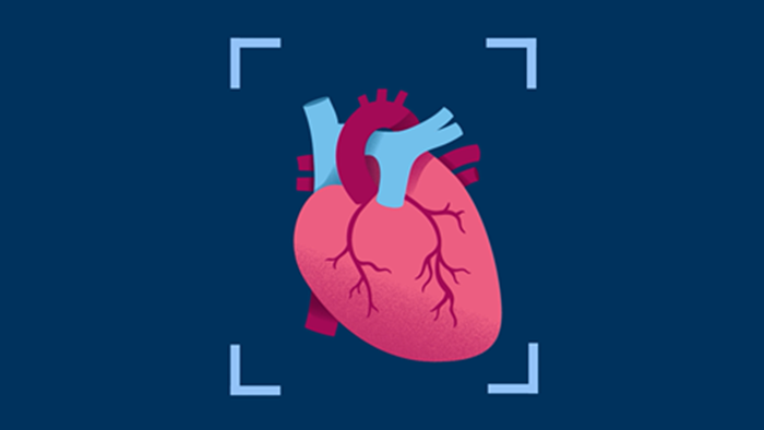 Video cardiaal